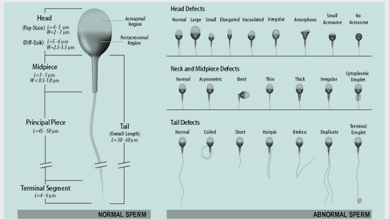 a-game-of-numbers-sperm-count-and-semen-analysis-the-free-nude-porn